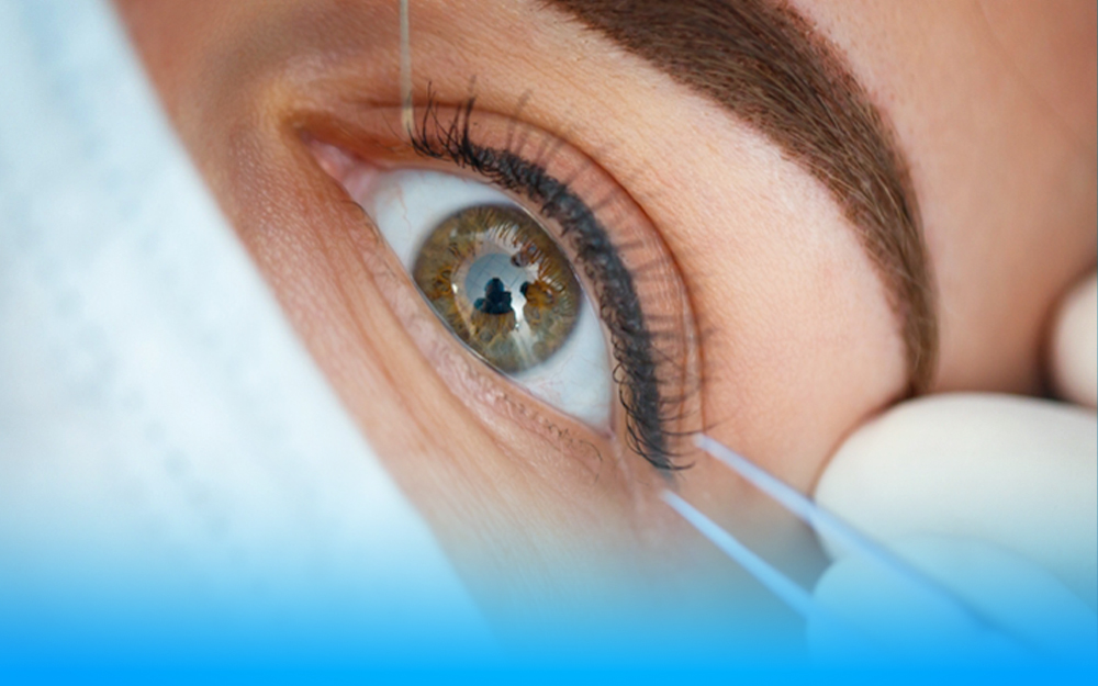 Oculoplastic & Orbital Clinic
