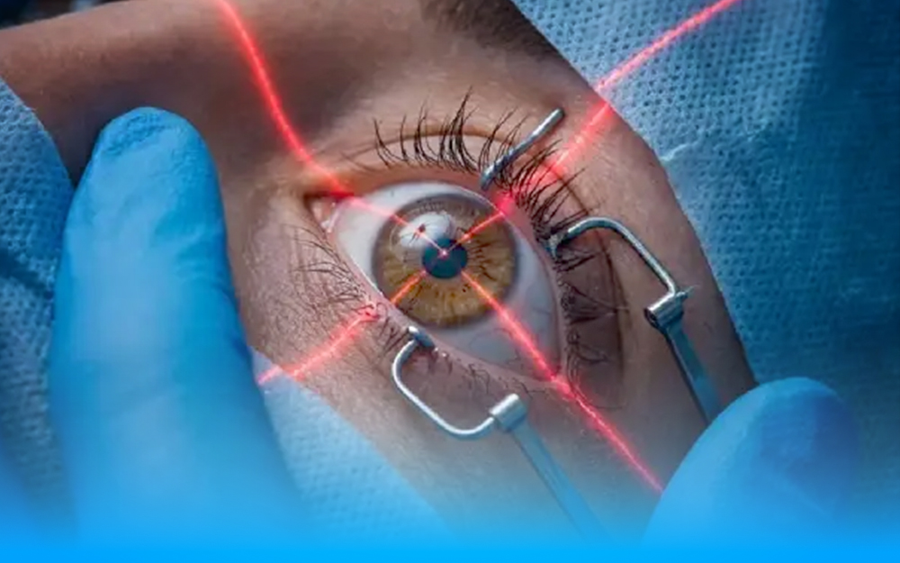 Vision Correction Clinic