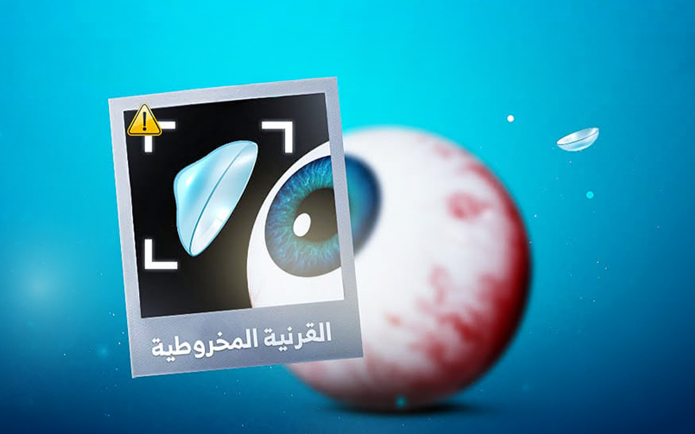 Ocular Surface Disease Clinic